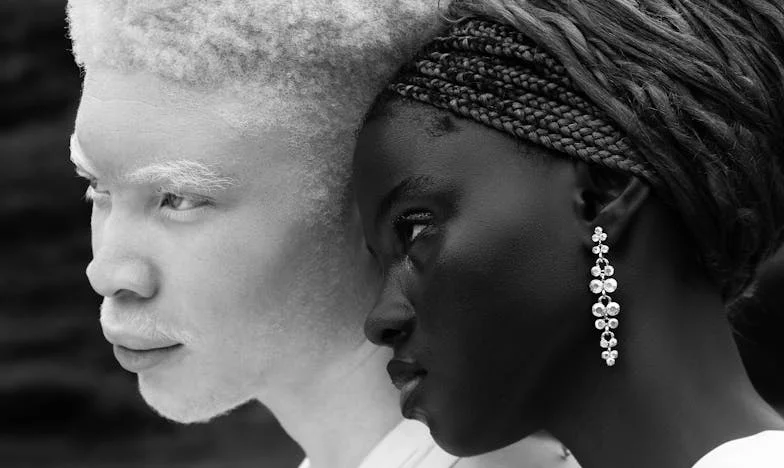 Le Retour d'une Voix Oubliée sur la Place de la Comédie