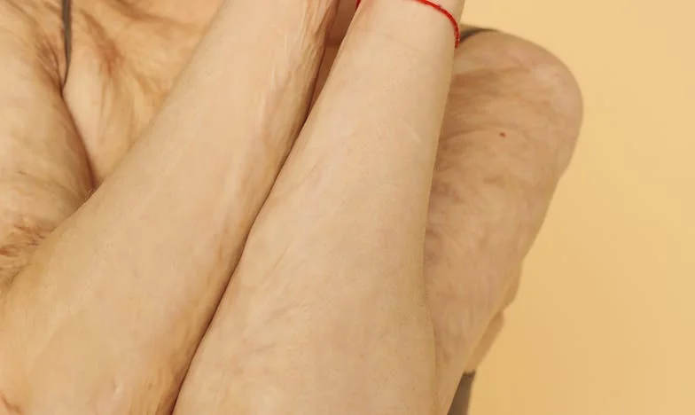 Невидимият товар на любовта: История за мен и Ева, която преобърна представите ми за красотата