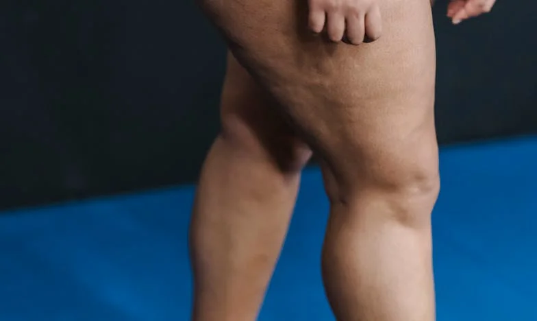 Snaja respinsă: Povestea Anei, femeia pe care familia nu a vrut-o niciodată